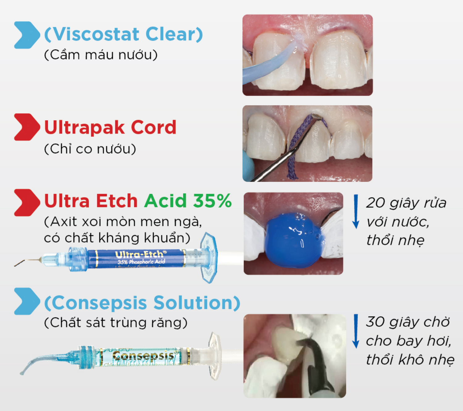 Các bước sử dụng bộ vật liệu gắn mặt dán sứ veneer của hãng Ultradent🌱NHA KHOA MALL🌱